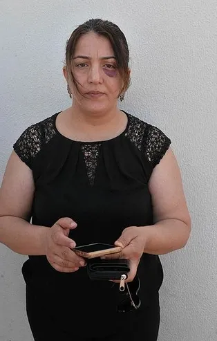 Adana'da yaralıya müdahale eden hemşire ve eşine sopalı saldırı