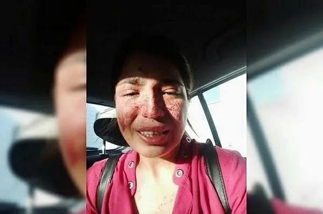 Eski eşinin saldırısına uğrayan kadından yardım çığlığı: Bu cani beni öldürmeden onu durdurun