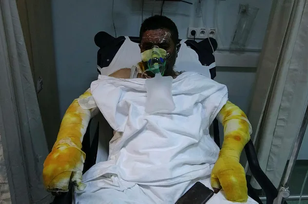 Ailesini kurtardı kendisi yandı! Samsun'da inanılmaz fedakarlık