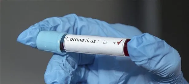 Koronavirüs durdurulamıyor! Ölü sayısı kritik eşiği aştı
