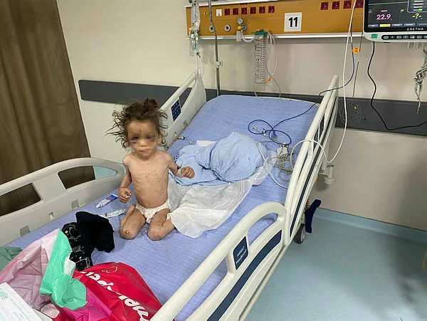 Gaziantep'te skandal olay! Cani anne 5 yaşındaki çocuğuna işkence yapıp aç bırakmış! O cani anne tutuklandı-3