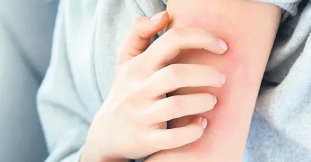 Uzmanı uyarıyor! Havasız ortamlarda artıyor: Bulaş riski yüksek