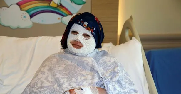 Erzurum’da korkunç olay! Patlayan düdüklü tencere yüzünde ve vücudunda derin yanıklar oluşturdu