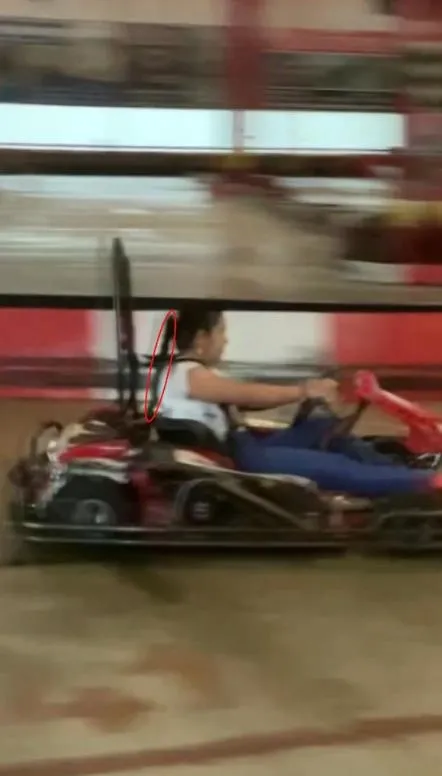 antalyada-go-kart-faciasi-saci-tekerlege-dolaninca-kafa-derisi-yerinden-siyrildi-1694359989571.jpeg Antalya'da Go-kart faciası! Saçı tekerleğe dolanınca kafa derisi yerinden sıyrıldı: Genç kız ölümden döndü-9