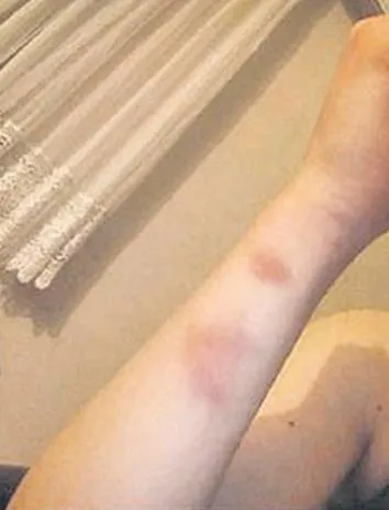 Bu cani ser'pest': Ret cevabı veren sevgilisine dehşeti yaşattı!-2