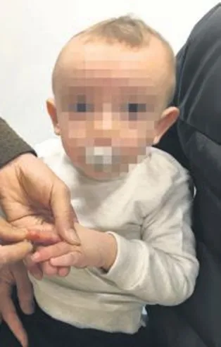 Konya'da sünnet derisinden parmağa yama!