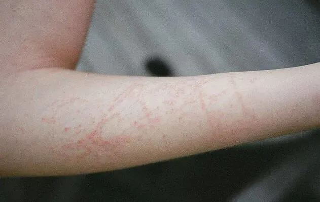 marmara-denizine-girenler-dikkat-gorulmeye-baslandi-uzmanlar-alarm-veriyor-1720019508597.jpg ALARM VERİLDİ: Görülmeye başlandı! Marmara denizine girenler dikkat!-6