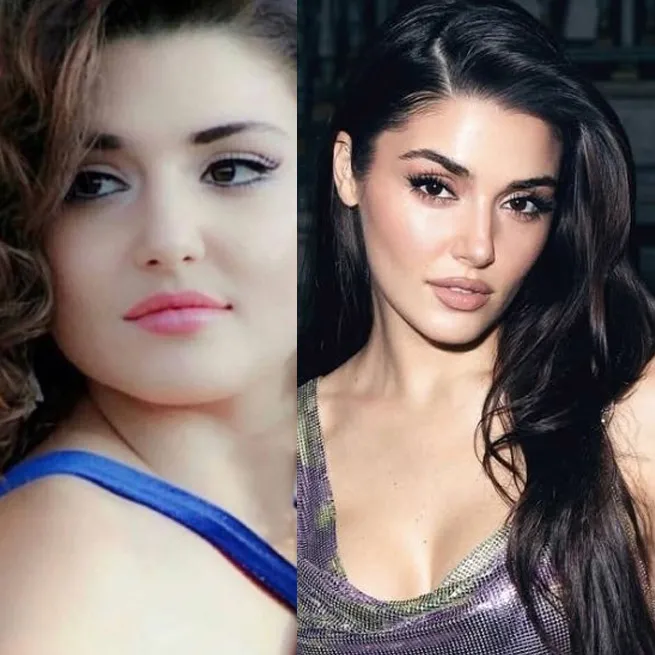 Yasemin Özilhan estetik açıklamasıyla sosyal medyanın diline düştü: Yeme bizi Yasemin! - 13