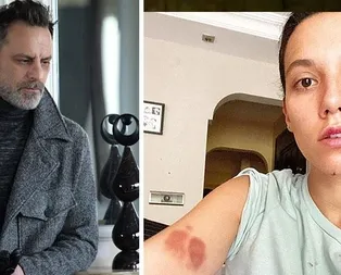 Şiddetin faili Ozan Güven olunca ortada yoklar!