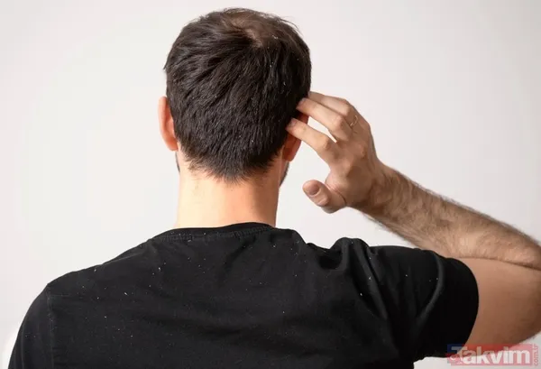 Pütür pütür cilt tarih oluyor: Kış yüzü sendromuna kesin çözüm - 4