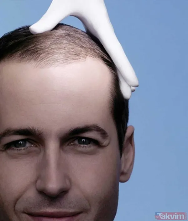 Bilim insanları tek yöntemle tarihe gömdü! Kelliğin dermanı sonunda bulundu! 40 yıl düşünsek aklımıza gelmez meğer... - 6