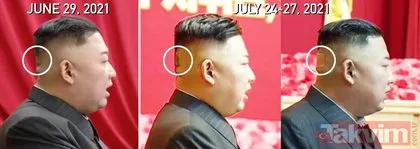 SON DAKİKA: Dünyanın konuştuğu fotoğraf! Kim Jong-un’un ensesinde kocaman bir yara bandı var