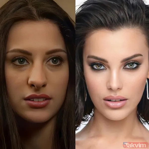 Yeşilçam’ın Sultan’ı Türkan Şoray'ın kızı Yağmur Ünal’ın son haline bakın! Botokstan konuşamadı! Gören şaştı kaldı - 11