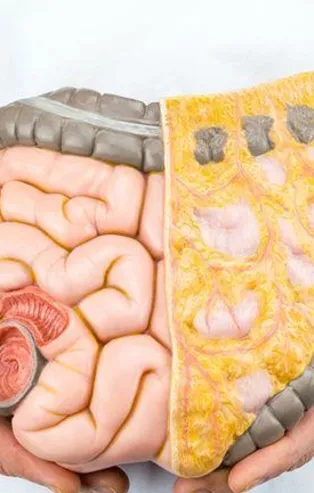 Sinsi ilerleyen kolon kanseri ilk evrelerde belirti vermiyor!