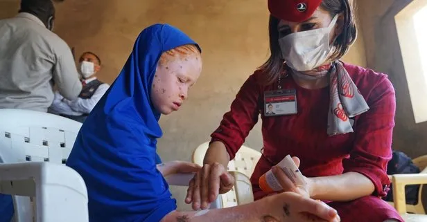 THY Afrika’da güneşten saklanan albino hastası çocuklara merhem oldu