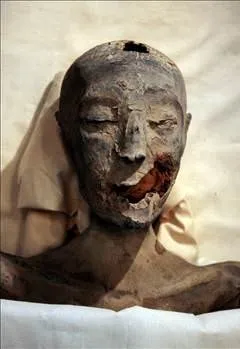 Tutanhamun’un neden öldüğü ortaya çıktı