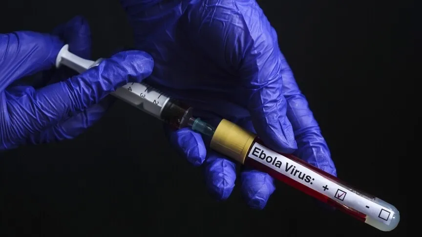 dunya-kupasi-oncesi-ebola-krizi-trump-avrupayi-hedefe-koydu-1781020103899.jpeg Dünya Kupası öncesi Ebola krizi: Trump Avrupa’yı hedefe koydu-4
