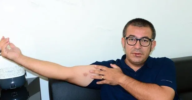 Saldırıya uğrayan A Haber muhabiri dehşet dolu anları anlattı: Kravatımla boğmaya çalıştılar! Devlet tarafından yapılan hizmetleri paylaşmamızı istemiyorlar