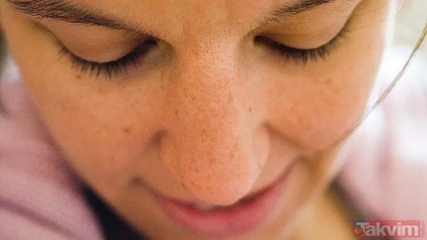 Pütür pütür cilt tarih oluyor: Kış yüzü sendromuna kesin çözüm - 7