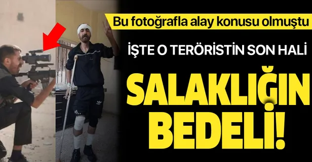 Dürbün kapağını açmadan ateş etmeye çalışan YPG’li teröristin son hali! Yine alay konusu oldu