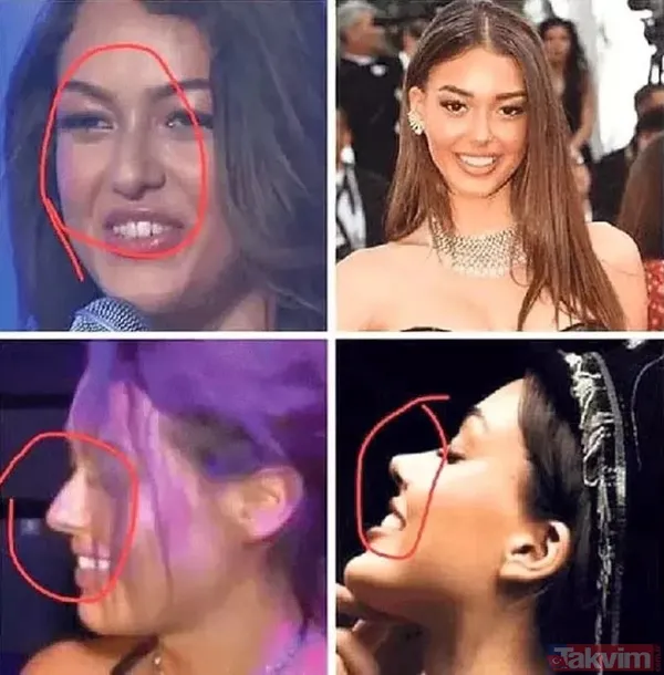 Dilan Çiçek Deniz'den aşk iddialarına jet yanıt! “Taciz” deyip açıkladı! Gözler Demet Özdemir’in eski eşi Oğuzhan Koç’ta... - 22