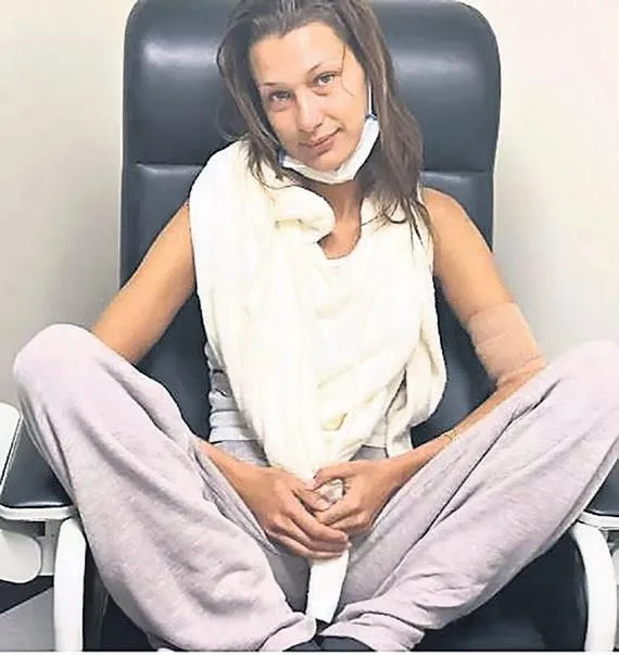 bellali-hastalik-1691442005099.jpeg Bella Hadid’in Lyme hastalığı için tedavi gördüğü ortaya çıkmıştı! O anlarını paylaştı...-3