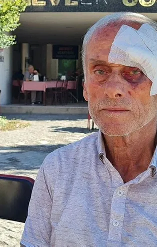 CHP Karabük İl Başkanlığında darp skandalı! 72 yaşındaki parti üyesi il sekreteri tarafından hastanelik edildi