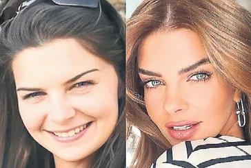 Pelin Karahan estetik iddialarına noktayı koydu