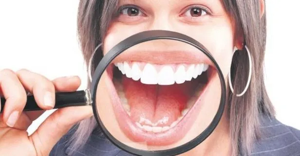 Çürük diş erken bunatır! Diş sağlığı iyi olmayan kişilerde Alzheimer’a yakalanma riski artıyor