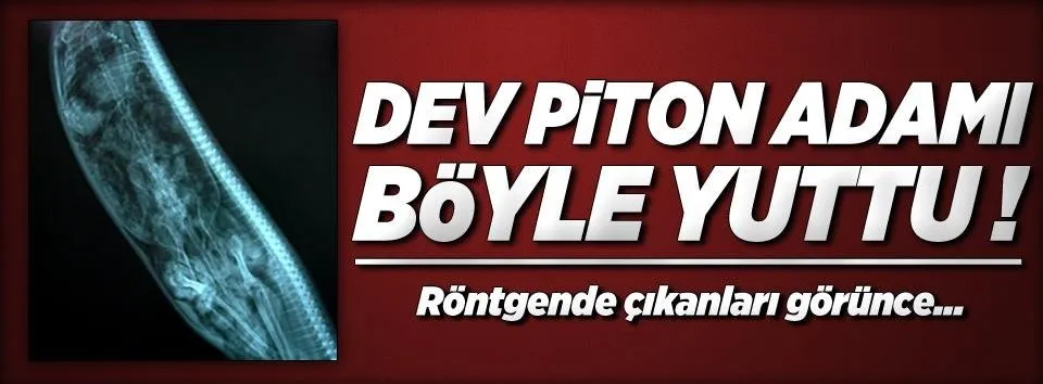 Akıl almaz röntgen görüntüleri!