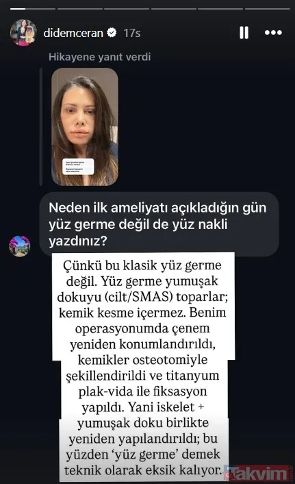 Eski Survivor yarışmacısı Didem Ceran Güney Kore'de 15 saatlik "yüz nakli" operasyonu geçirdi - 3