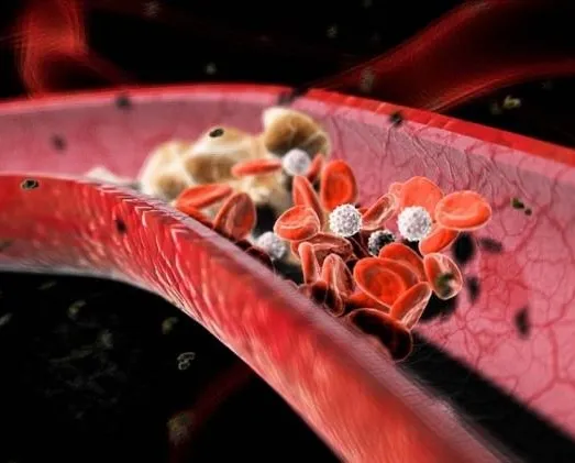 Kolesterolün de hayırlısı