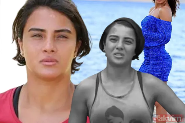 Tanımak imkansız! Survivor Sabriye Şengül estetiğin dozunu kaçırınca bambaşka biri oldu! Hem son hali ham de iddialı pozlarıyla... - 1