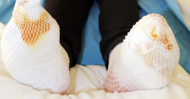 Iğdır'dan Erzurum'a giden kamyon şoförünün ayakları dondu