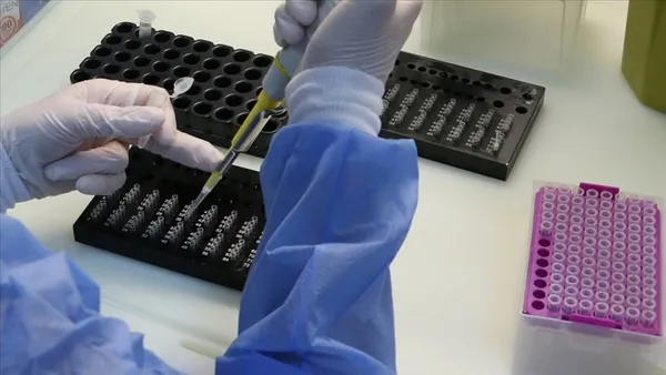 japon-arastirmacilar-kovid-19u-5-dakikada-saptayabilen-test-yontemini-buldu-1618897093561.jpg Japon araştırmacılar Kovid-19'u 5 dakikada saptayabilen test yöntemini buldu-3