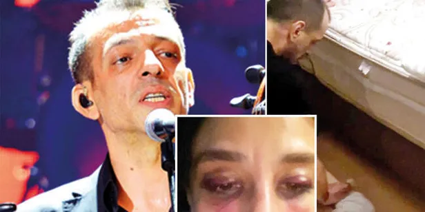 Ozan Güven'in ardından şiddet haberi bu kez de Rubato'nun solistinden geldi! Özer Arkun’un sevgilisi yaşadığı dehşeti anlattı!-2