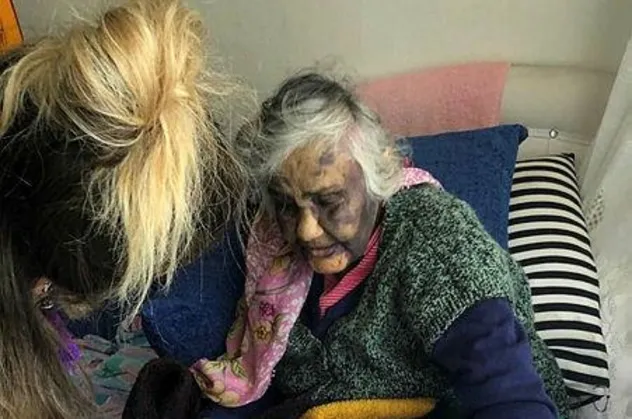 Bunun adı vicdansızlık! Zonguldak'ta 83 yaşındaki kadına darp