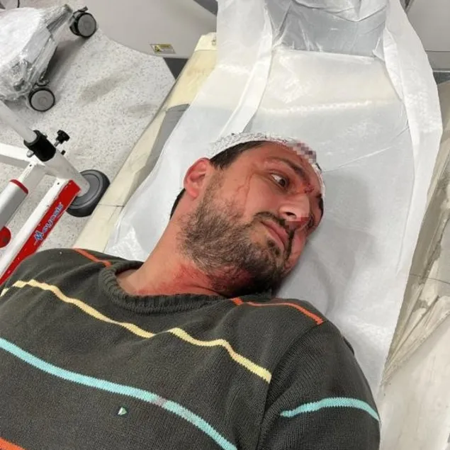 Otizmli genç darbedildi.