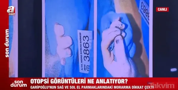 Münevver Karabulut dosyasında yeni gelişme! 10 yıl sonra Cem Garipoğlu'nun otopsi görüntüleri ortaya çıktı! Parmakları neden mordu? Uzman isim yanıtladı - 9