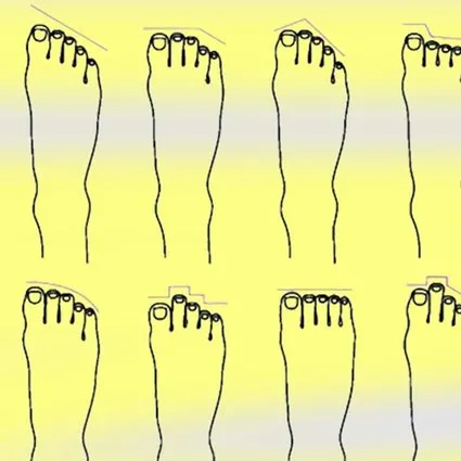 Ayak parmaklarınız bu şekildeyse hangi ırktan geldiğiniz ortaya çıkıyor