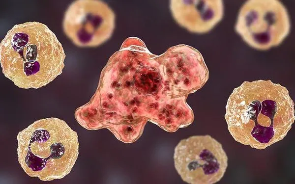 1594197476174.jpg Beyin yiyen amip nedir? Beyin yiyen amip belirtileri neler? Beyin yiyen amip Türkiye’de var mı?-3