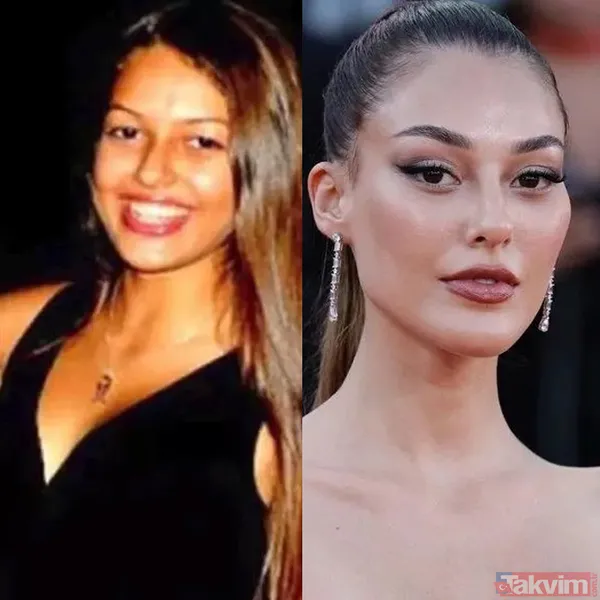 Yeşilçam’ın Sultan’ı Türkan Şoray'ın kızı Yağmur Ünal’ın son haline bakın! Botokstan konuşamadı! Gören şaştı kaldı - 18