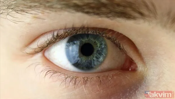 Birçok kişi fark etmiyor: Bulanık görme aslında körlüğün ilk habercisi olabilir - 3