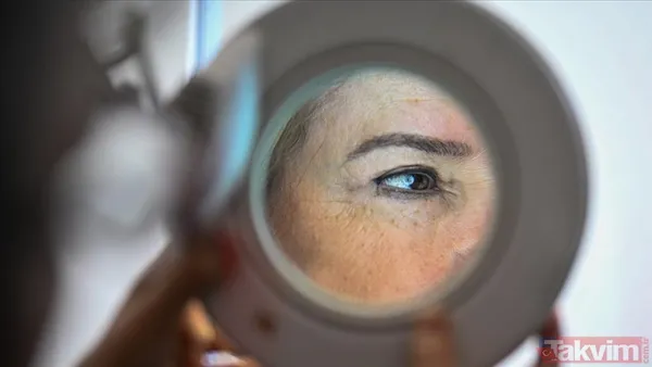 Pütür pütür cilt tarih oluyor: Kış yüzü sendromuna kesin çözüm - 5