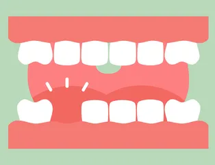 Rüyada diş çıktığını görmek ne anlama gelir?