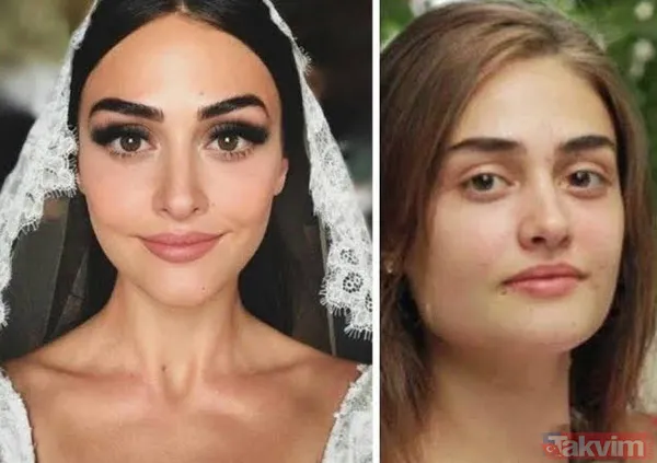 Ramo'nun Sibel'i Esra Bilgiç'in bu halini gören Esra olduğuna inanmıyor! Estetik var mı yok mu Esra Bilgiç açıkladı - 25