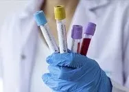 Yeni vaka 933’e indi