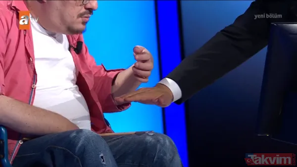 3 takla atan araçtan Milyoner koltuğuna: Günal Şen'in tek umudu beyin çipi taktırmak - 2