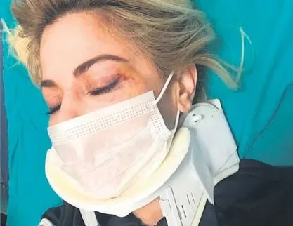 Sosyetik Burcu Şendir Kartalkaya’da ölümden döndü:-5