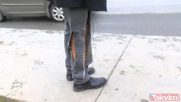 Bağcılar'da başıboş köpek saldırısı! Bacağından yakaladı - 8